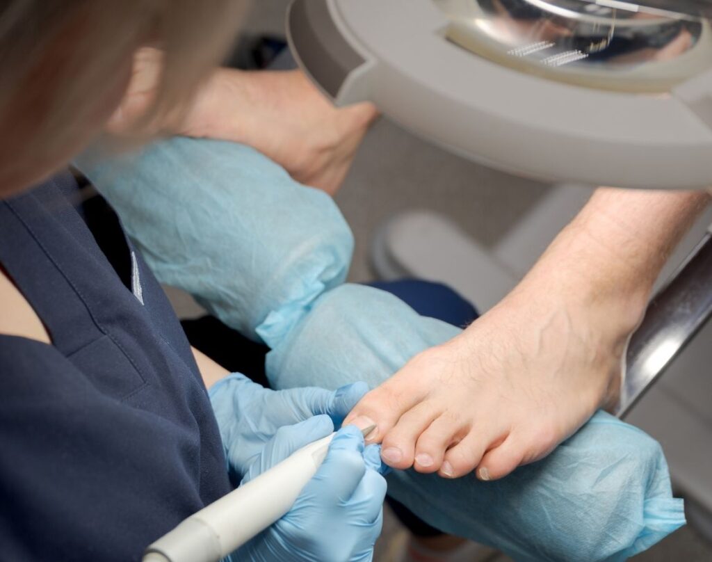 pedicure-medyczny-podologia-krakow-ultramed