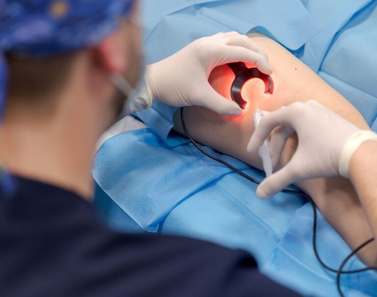 zylaki-skleroterapia-krakow-ultramed