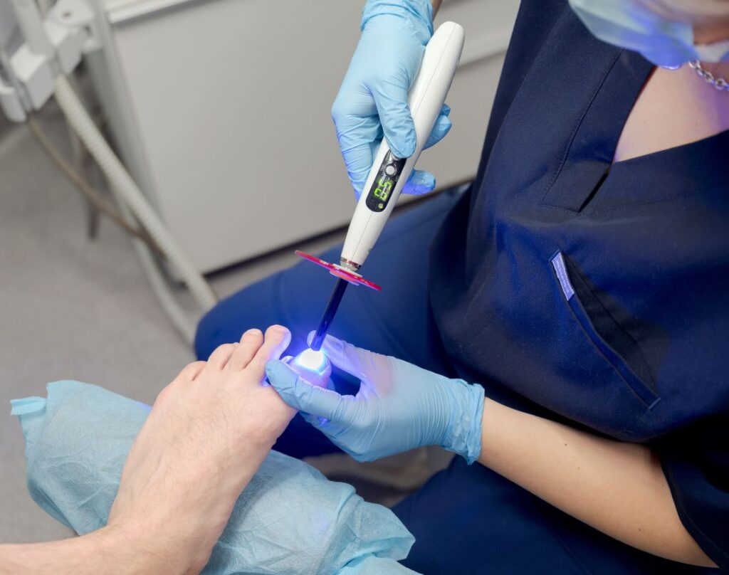 grzybica-stop-paznokci-krakow-ultramed